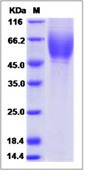 Hepatitis C virus (HCV) (serotype 1c,isolate HC-G9) E2 Recombinant Protein (His Tag)(Discontinued)