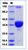 SARS coronavirus Plpro / papain-like protease(Discontinued)