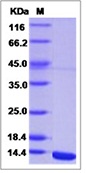 West Nile Virus (WNV) (lineage 2, strain Nea Santa-Greece-2010) E / Envelope Recombinant Protein (Domain III, His Tag)(Discontinued)