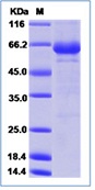 Coxsackievirus A16 (Cox A16) (strain G-10) VP1 Recombinant Protein (Fc Tag)(Discontinued)