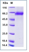 Influenza A H1N1 (A/Michigan/45/2015) Neuraminidase / NA (His Tag)(Discontinued)