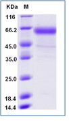 Influenza A H3N2 (A/Hong Kong/4801/2014) Neuraminidase / NA (His Tag)(Discontinued)