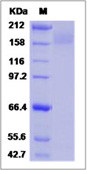 HIV-1 gp140 Recombinant Protein (group P, strain RBF168) (Fc Tag)(Discontinued)