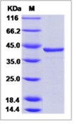 Hepatitis C virus (HCV-1a) NS3 protease / helicase immunodominant region Recombinant Protein (aa 1356-1459, GST Tag)(Discontinued)