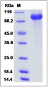 SARS-CoV Spike/S1 Protein (S1 Subunit, His Tag)(Discontinued)