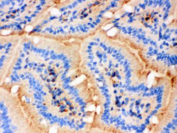 Anti-Actin Monoclonal Antibody (Clone: AC-40)