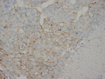 Anti-AFP Monoclonal Antibody (Clone: C3)