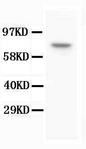 Monoclonal Antibody to Anti-BAP1 Antibody(Clone: 3C11)(Discontinued)