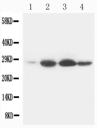 Anti-Bcl-2 Monoclonal Antibody (Clone: Bcl-2-100)