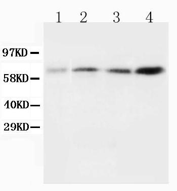 Anti-BIN1 Monoclonal Antibody (Clone: 99D)(Discontinued)