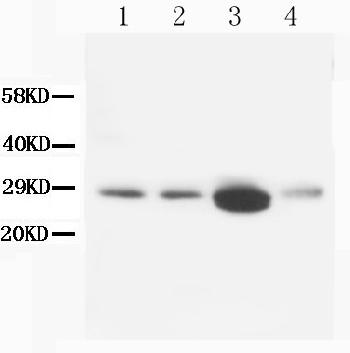 Anti-Calbindin-D Monoclonal Antibody (Clone: CB-955)