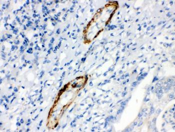 Anti-Caldesmon(smooth) Monoclonal Antibody (Clone: hHCD)