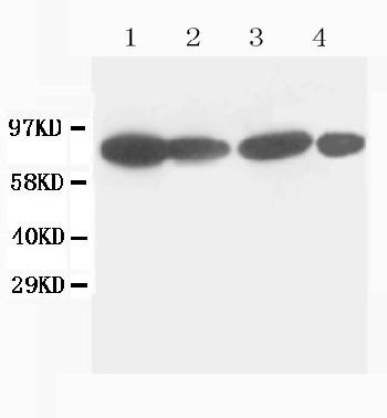 Anti-Catenin gamma (Plakoglobin) Monoclonal Antibody (Clone: 15F11)