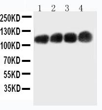 Anti-CEA Monoclonal Antibody (Clone: C6G9)