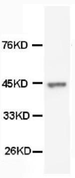 Anti-Cytokeratin Peptide 18 Monoclonal Antibody (Clone: CY-90)