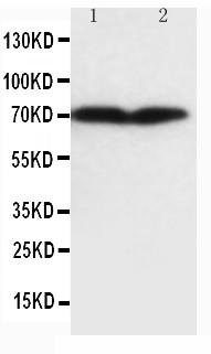 Anti-Collagen, Type III Monoclonal Antibody (Clone: FH-7A)