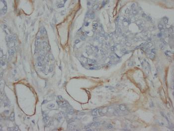 Anti-Collagen, Type IV Monoclonal Antibody (Clone: COL-94)