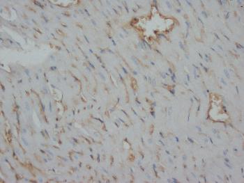 Anti-Desmin Monoclonal Antibody (Clone: DE-U-10)