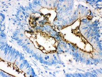 Monoclonal Antibody to Anti-Episialin, EMA Antibody(Clone: GP1.4)