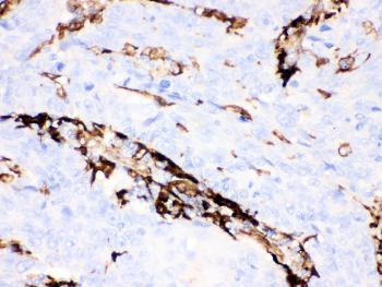 Anti-Gelsolin Monoclonal Antibody (Clone: GS-2C4)