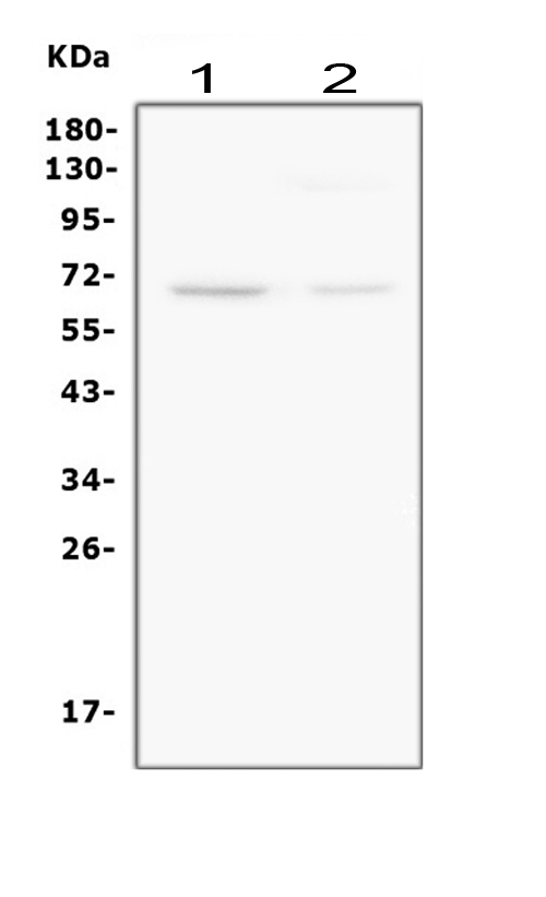 Anti-Smad4 (DPC4) Monoclonal Antibody (Clone: DCS-46)