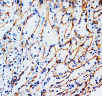 Anti-Vimentin Monoclonal Antibody (Clone: V9)