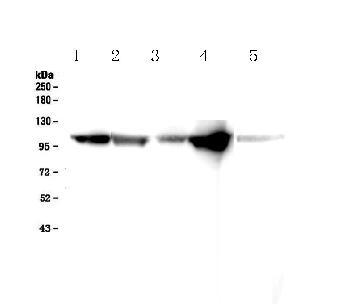 Anti-alpha-Actinin Monoclonal Antibody (Clone: EA-53)