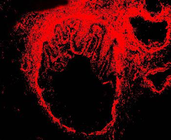 Anti-alpha-Smooth Muscle Actin Monoclonal Antibody (Clone: 1A4)