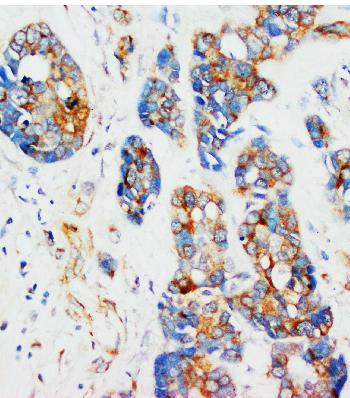 Anti-alpha-Tubulin Monoclonal Antibody (Clone: DM1A)