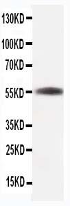 Anti-beta-Tubulin Monoclonal Antibody (Clone: TUB 2.1)