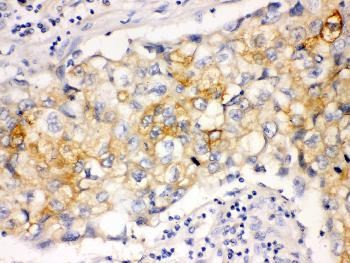 Monoclonal Antibody to Anti-Involucrin Antibody(Clone: SY5)