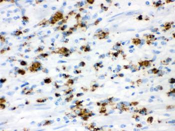 Anti-Mucin Gastric Monoclonal Antibody (Clone: 45M1)