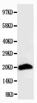 Anti-Myosin (Skeletal, Fast) Monoclonal Antibody (Clone: MY-32)