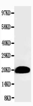 Anti-Myosin (Skeletal, Slow) Monoclonal Antibody (Clone: NOQ7.5.4D)