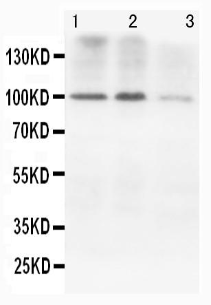 Anti-N-Cadherin Monoclonal Antibody (Clone: GC-4)(Discontinued)