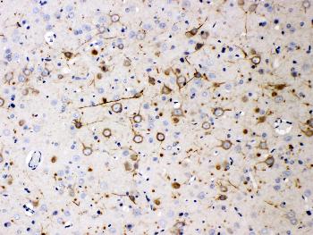 Anti-NF200 Monoclonal Antibody (Clone: N52)