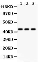 Monoclonal Antibody to Anti-Phosphoserine Antibody(Clone: PSR-45)(Discontinued)