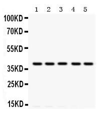 Anti-Tropomyosin (36/39 kDa) Monoclonal Antibody (Clone: TM31)