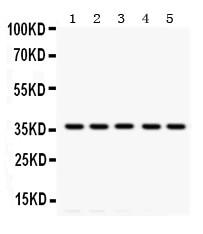 Anti-Tropomyosin (36kD) Monoclonal Antibody (Clone: TM228)(Discontinued)