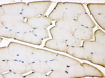 Anti-Troponin T Monoclonal Antibody (Clone: JLT-12)(Discontinued)