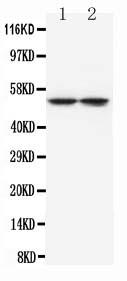 Monoclonal Antibody to Anti-Tryptophan Hydroxylase Antibody(Clone: WH-3)(Discontinued)