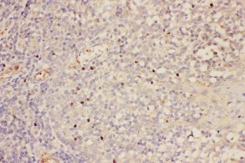 Anti-FOXP3 Polyclonal Antibody