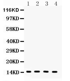 Anti-FABP4 Polyclonal Antibody