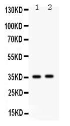 Anti-Fos B Polyclonal Antibody