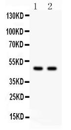 Anti-PTOV1 Polyclonal Antibody