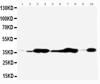 Anti-Annexin V Polyclonal Antibody