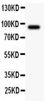 Polyclonal Antibody to Anti-ATF6 Antibody(Discontinued)