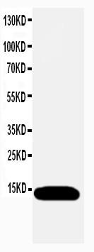 Polyclonal Antibody to Anti-ATP5J Antibody(Discontinued)