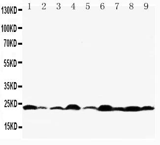 Polyclonal Antibody to Anti-Bax Antibody(Discontinued)