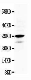 Anti-Calretinin Polyclonal Antibody